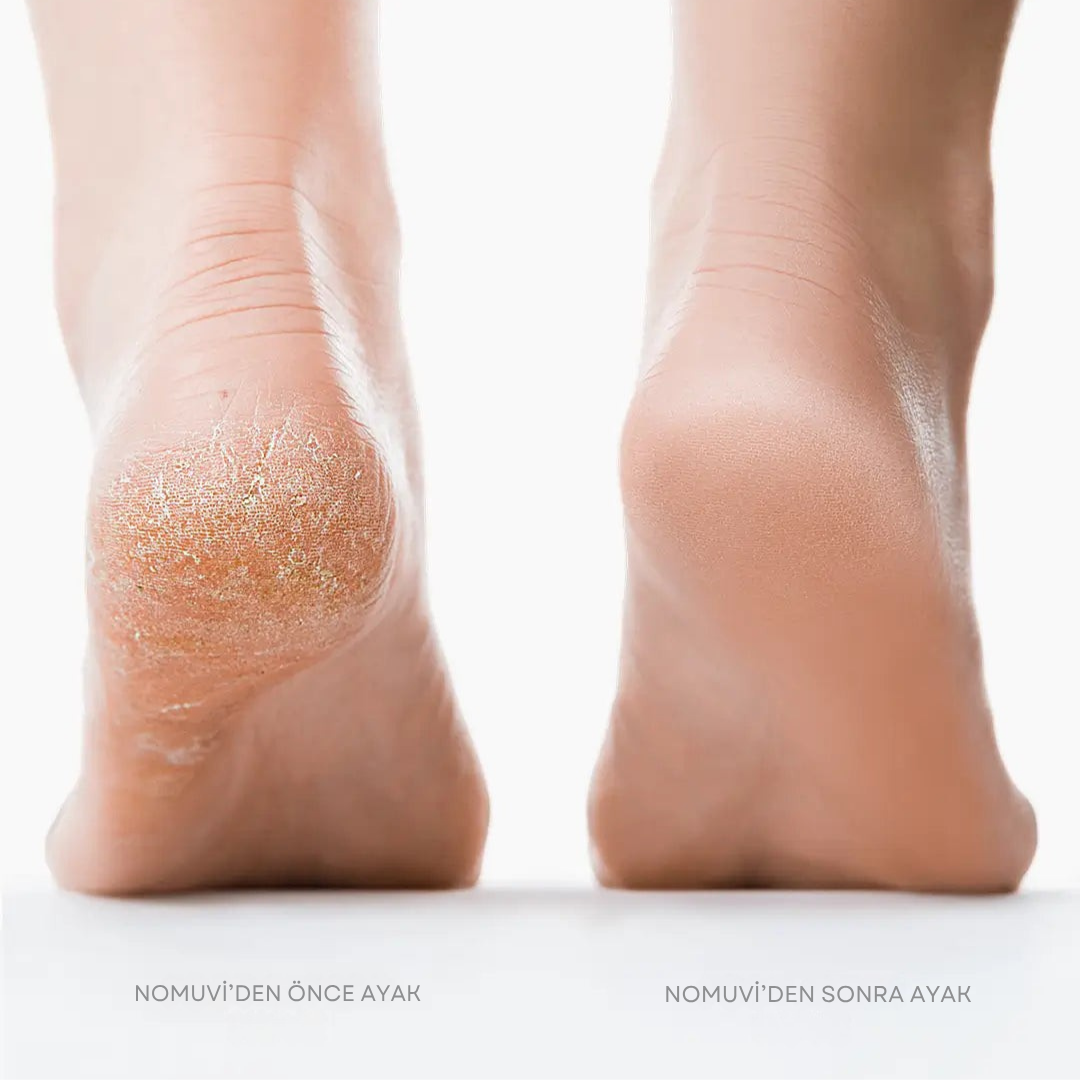Nomuvi Velvet Pro-Pedikür Ve Ayak Bakım Aleti