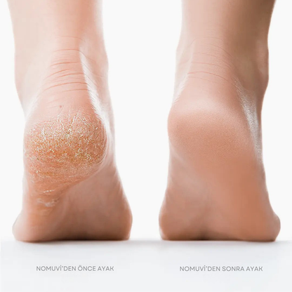 Nomuvi Velvet Pro-Pedikür Ve Ayak Bakım Aleti